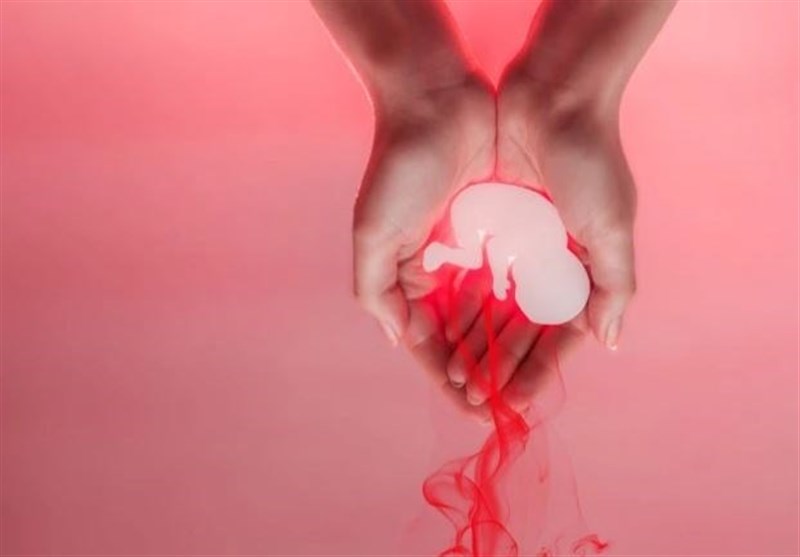 ۳ علت “سقط جنین” در کشور/ سقط تحت‌تأثیر شعارهای تنظیم خانواده